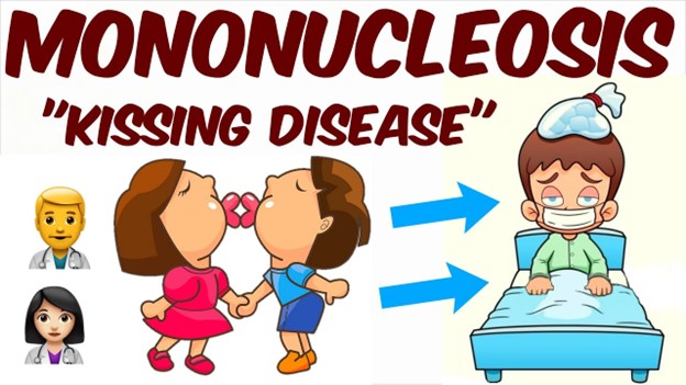 Mononucleosis: causes, symptoms, diagnosis, treatment